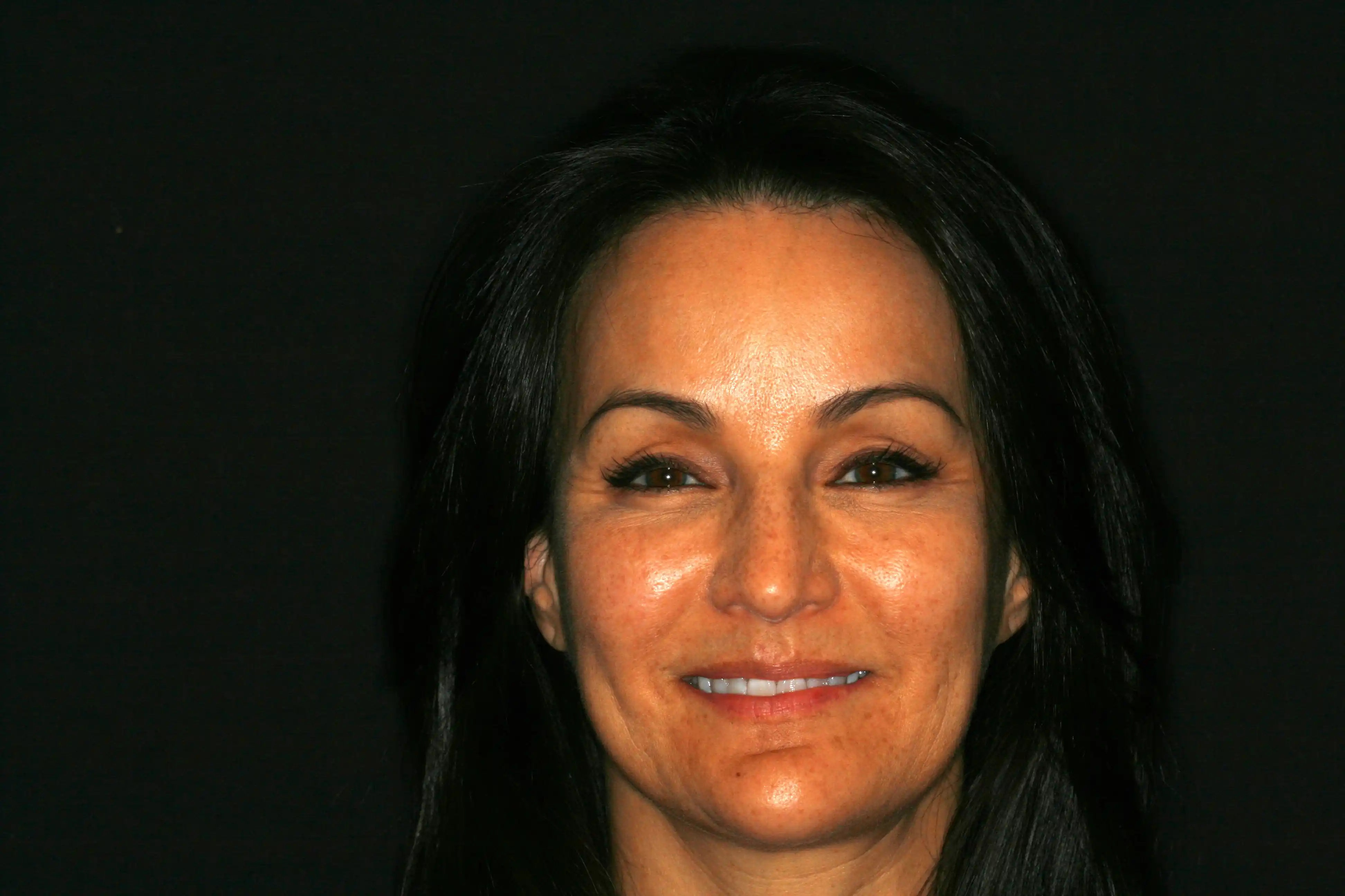 Konig Center for Cosmetic & Comprehensive Dentistry smile photos