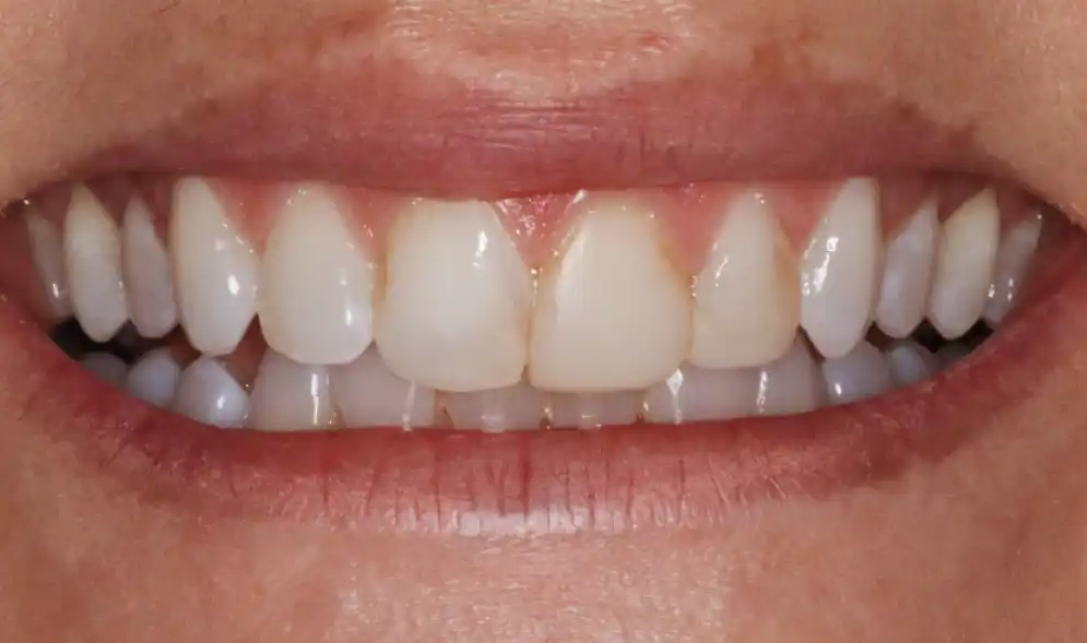 Konig Center for Cosmetic & Comprehensive Dentistry smile photos