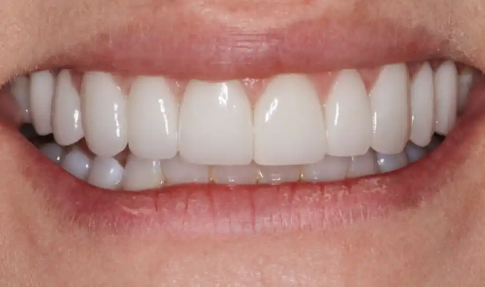Konig Center for Cosmetic & Comprehensive Dentistry smile photos