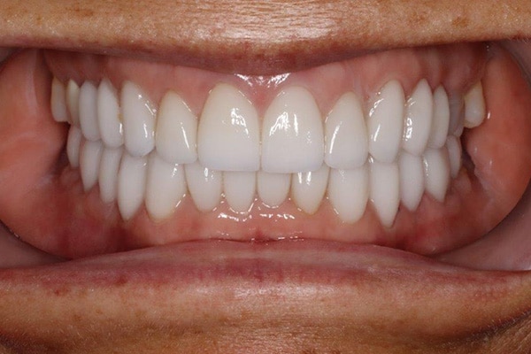 Konig Center for Cosmetic & Comprehensive Dentistry smile photos