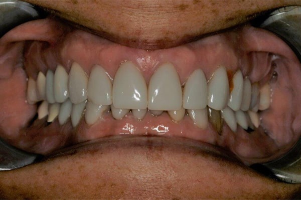 Konig Center for Cosmetic & Comprehensive Dentistry smile photos