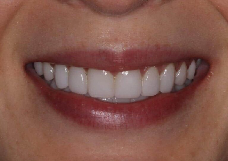 Konig Center for Cosmetic & Comprehensive Dentistry smile photos