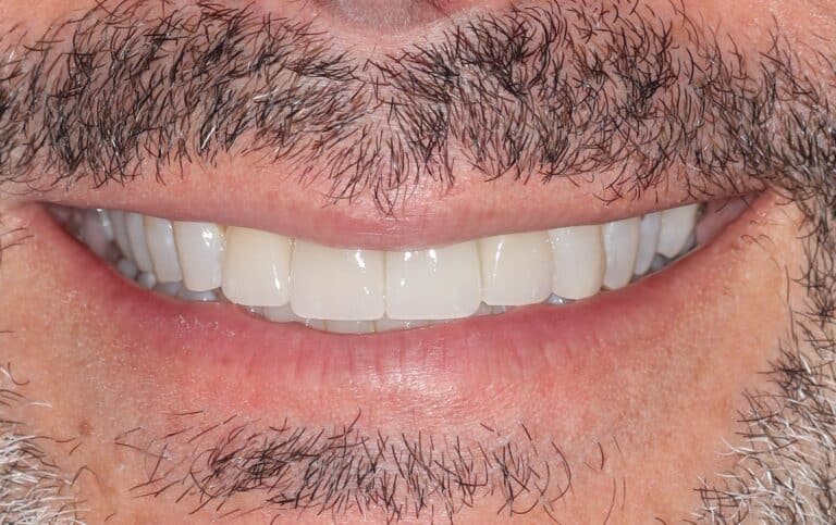 Konig Center for Cosmetic & Comprehensive Dentistry smile photos