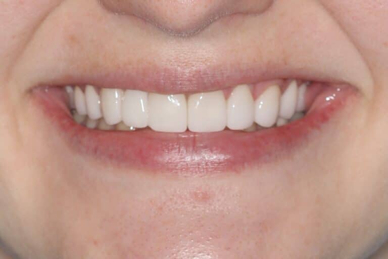 Konig Center for Cosmetic & Comprehensive Dentistry smile photos