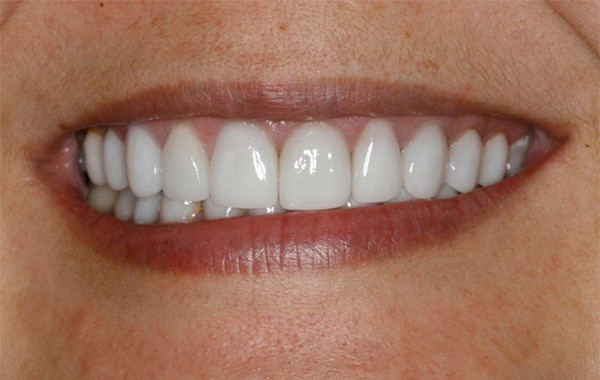 Konig Center for Cosmetic & Comprehensive Dentistry smile photos
