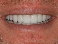 Konig Center for Cosmetic & Comprehensive Dentistry smile photos