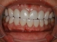 Konig Center for Cosmetic & Comprehensive Dentistry smile photos