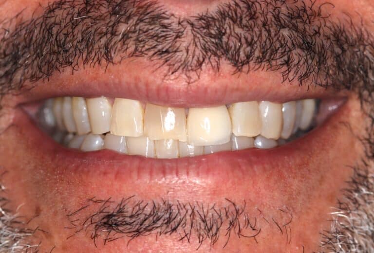 Konig Center for Cosmetic & Comprehensive Dentistry smile photos