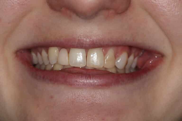 Konig Center for Cosmetic & Comprehensive Dentistry smile photos