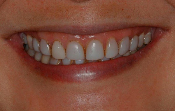 Konig Center for Cosmetic & Comprehensive Dentistry smile photos
