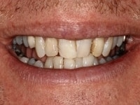 Konig Center for Cosmetic & Comprehensive Dentistry smile photos