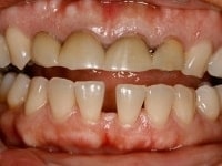 Konig Center for Cosmetic & Comprehensive Dentistry smile photos
