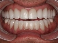 Konig Center for Cosmetic & Comprehensive Dentistry smile photos