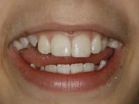 Konig Center for Cosmetic & Comprehensive Dentistry smile photos