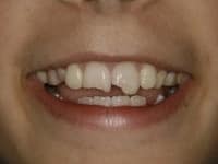 Konig Center for Cosmetic & Comprehensive Dentistry smile photos