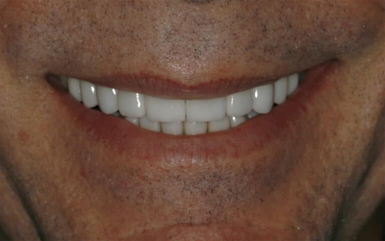 Konig Center for Cosmetic & Comprehensive Dentistry smile photos