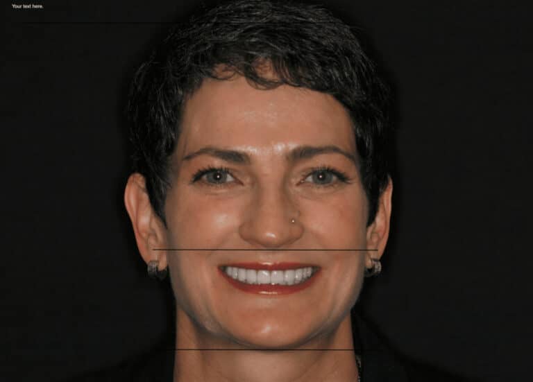 Konig Center for Cosmetic & Comprehensive Dentistry smile photos