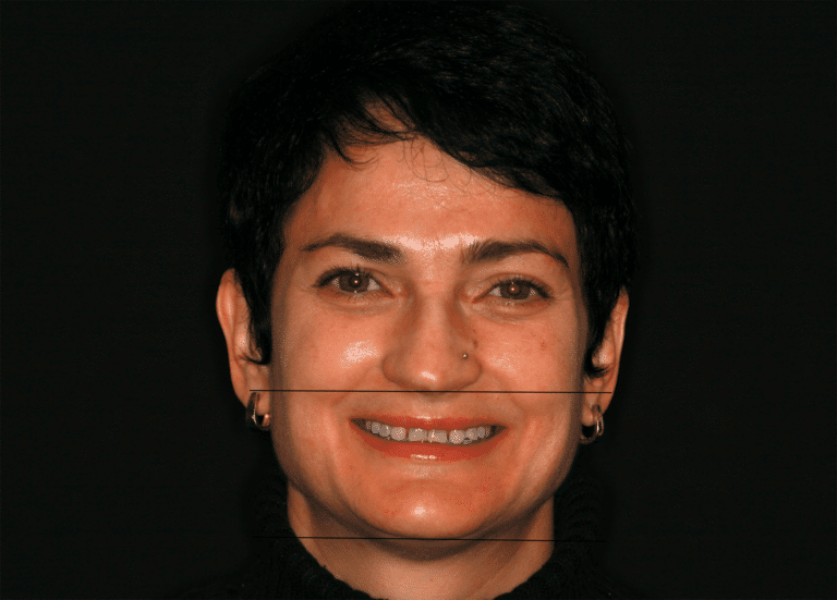 Konig Center for Cosmetic & Comprehensive Dentistry smile photos