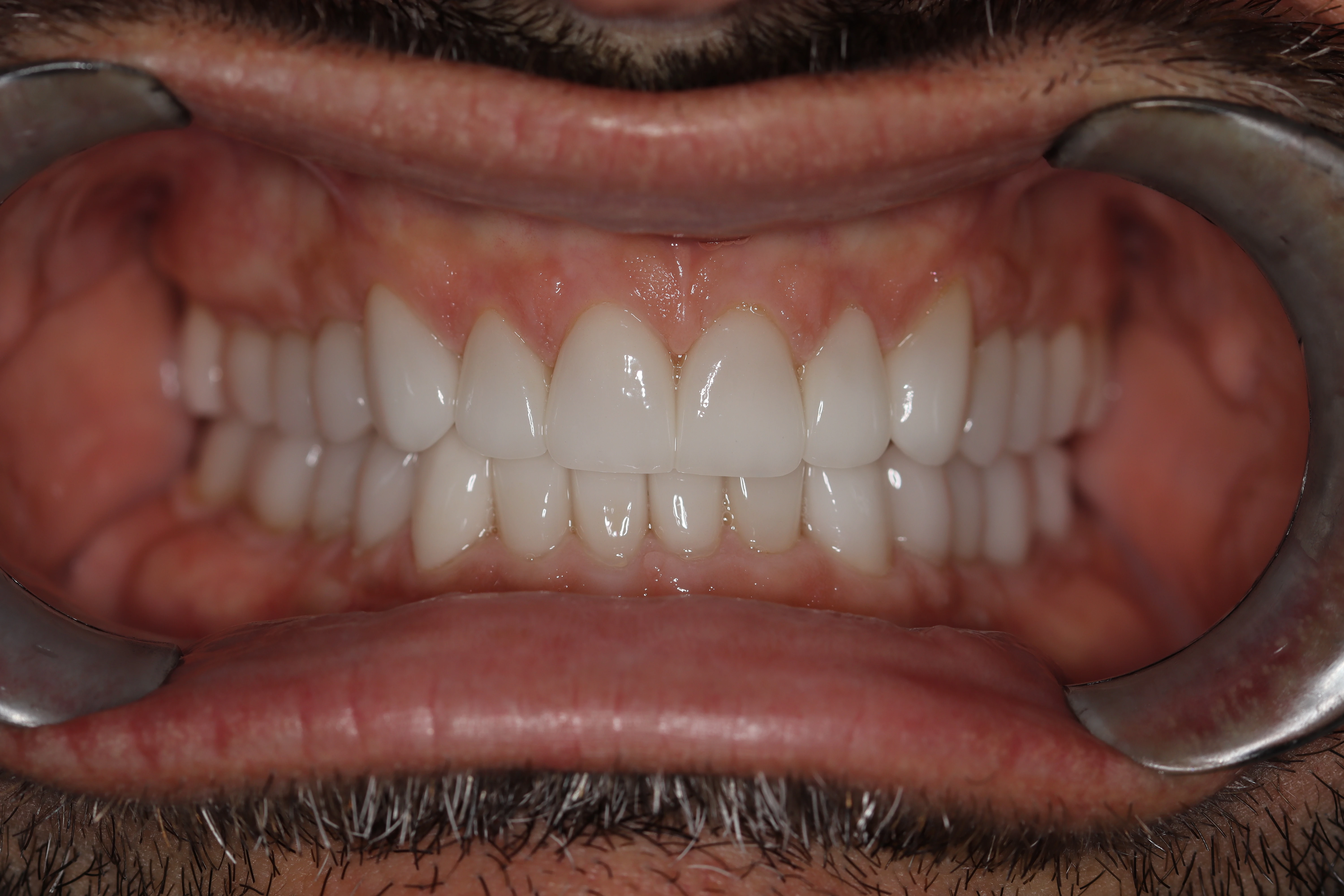 Konig Center for Cosmetic & Comprehensive Dentistry smile photos