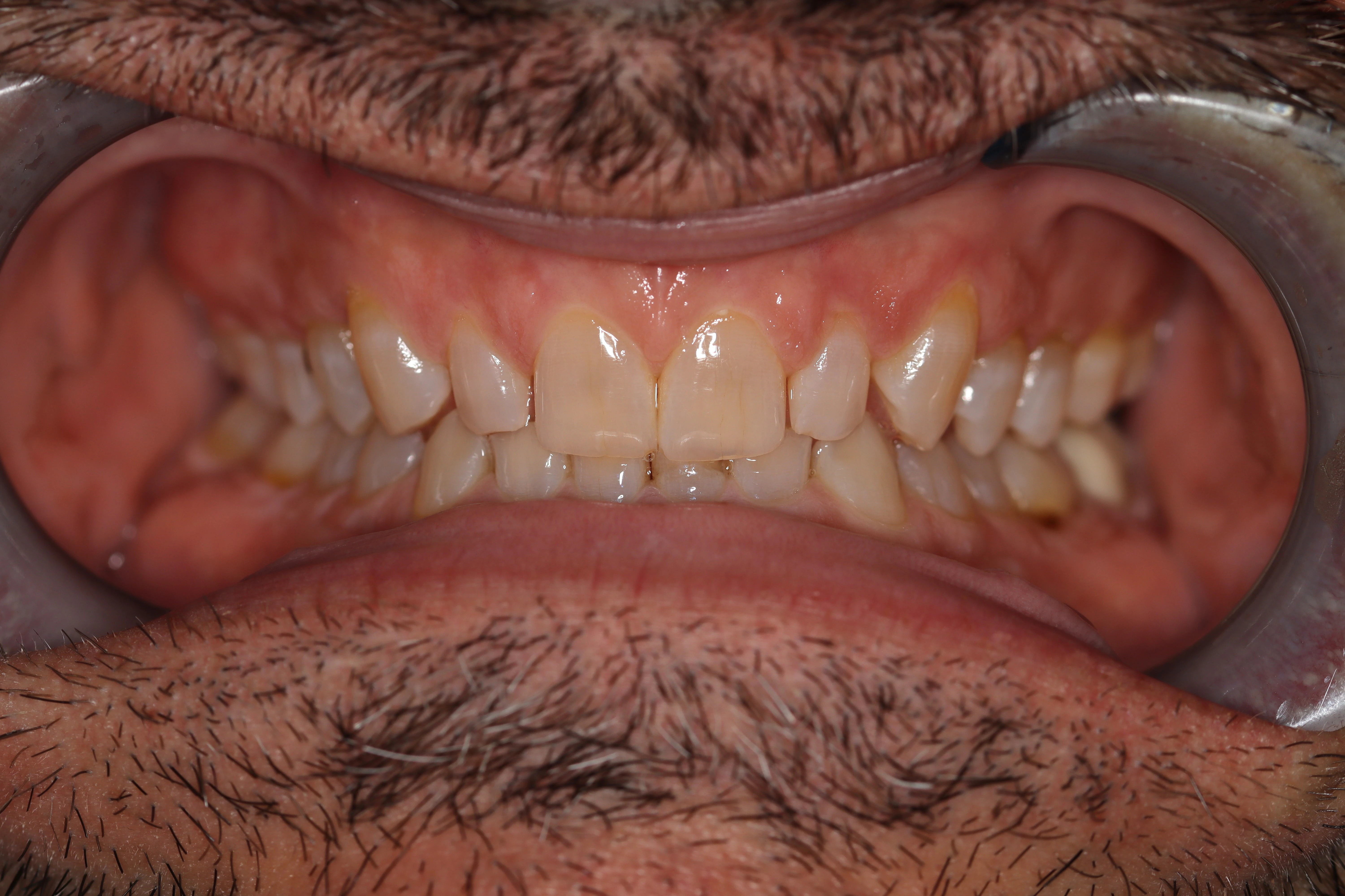 Konig Center for Cosmetic & Comprehensive Dentistry smile photos