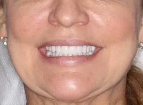Konig Center for Cosmetic & Comprehensive Dentistry smile photos