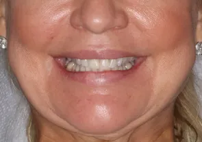 Konig Center for Cosmetic & Comprehensive Dentistry smile photos
