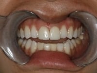 Konig Center for Cosmetic & Comprehensive Dentistry smile photos