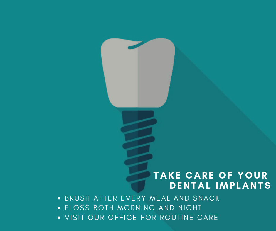 Dental Implant Care | Houston Implant Dentist