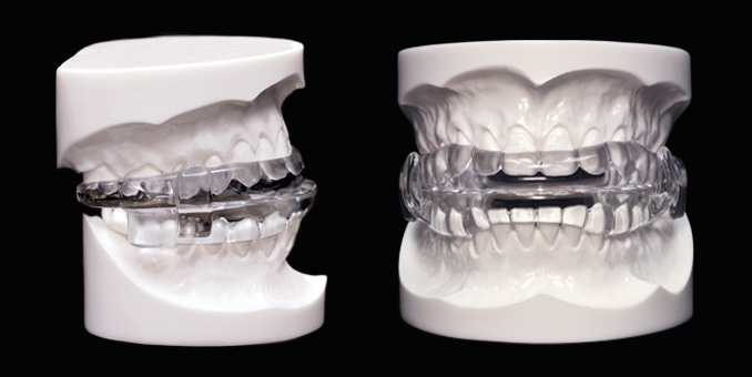 Micro2 sleep apnea treatment in Houstin