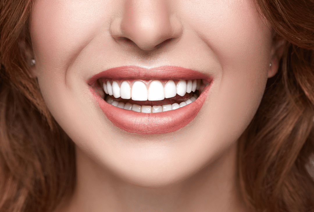 Why Consider Getting Both a Gum Lift & Veneers?
