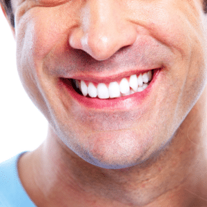 A man is smiling after undergoing a teeth whitening procedure.