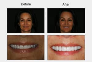 konig houstoncosmeticdentisttreatment pagegraphic