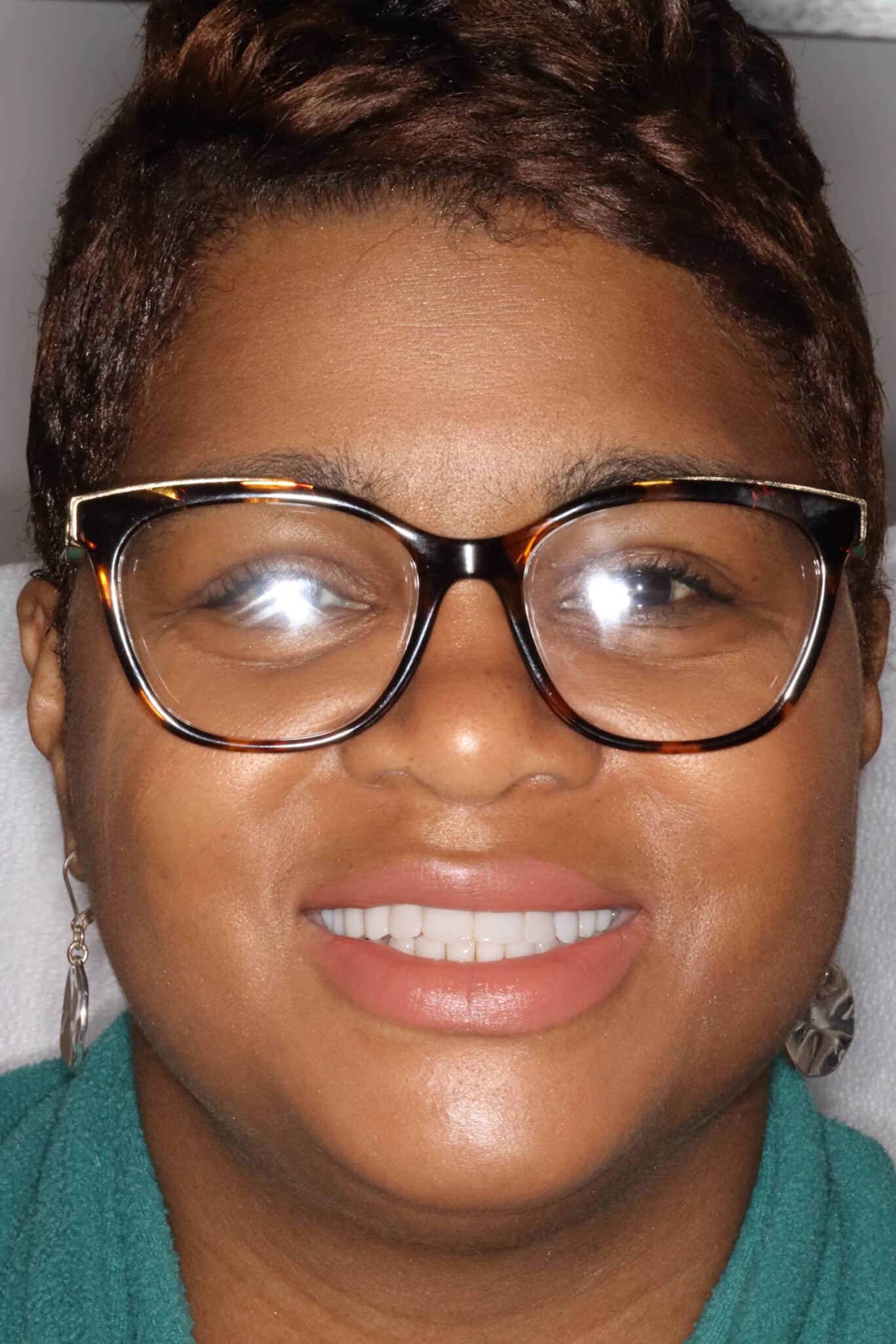 Can I Fix My Unattractive Underbite Without Surgery Konig Center for