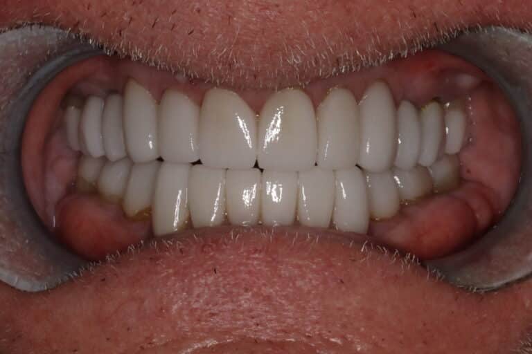After Image