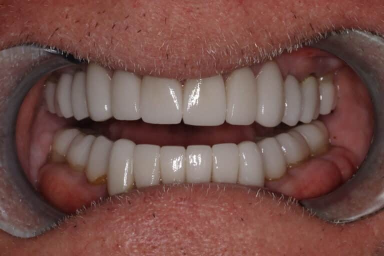 After Image
