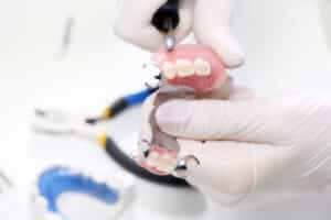 dentures or implants