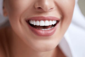 porcelain veneers houston tx