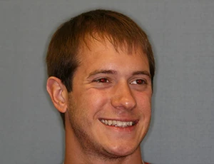 Man smiling before getting dental veneers