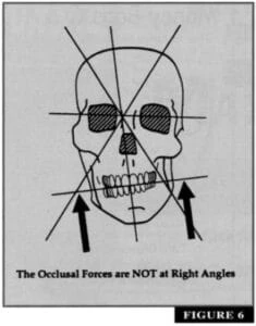 cranial derangement cranial derangement