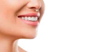 Veneer application process