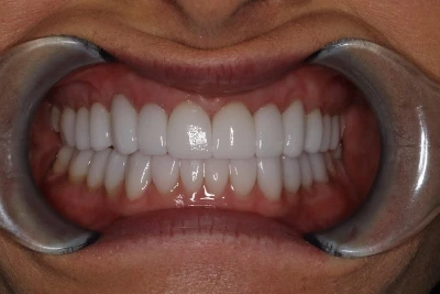 Konig Center for Cosmetic & Comprehensive Dentistry smile photos