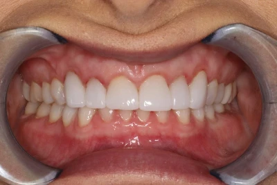 Konig Center for Cosmetic & Comprehensive Dentistry smile photos