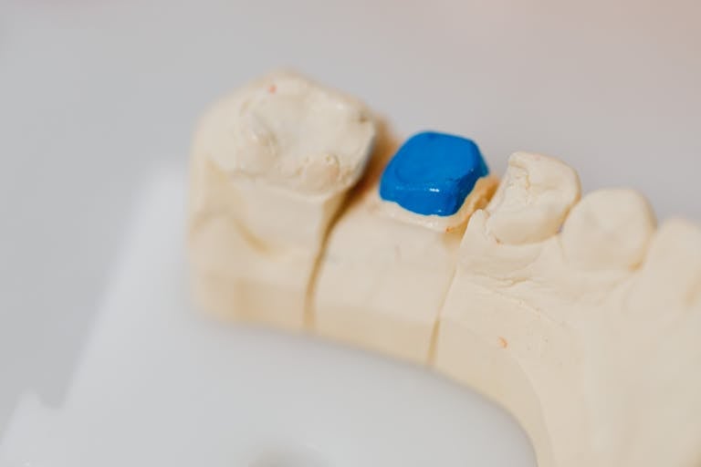 Close-up of a dental jaw model with a blue filling, showcasing dental anatomy and dentistry tools.