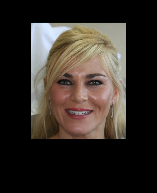 Alternatives to Jaw Surgery: There Are Better Approaches